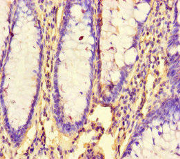 RHEB Antibody (PACO46562)