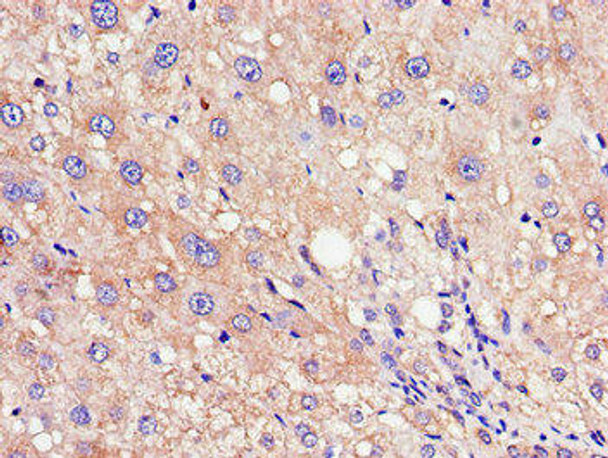 RND3 Antibody (PACO47618)