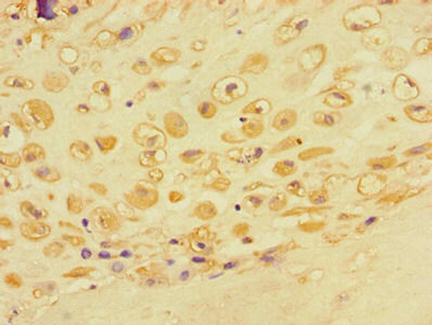 ACTR3 Antibody (PACO48134)