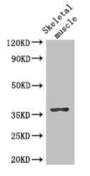 DNAJB6 Antibody (PACO48502)