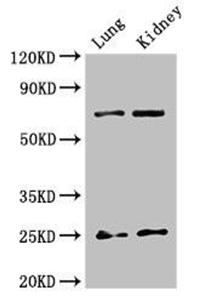 HMGB1 Antibody (PACO48958)