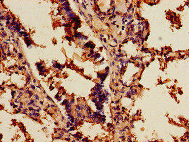 SCD Antibody (PACO49038)