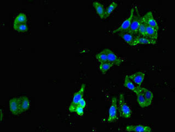 UPF1 Antibody (PACO49246)