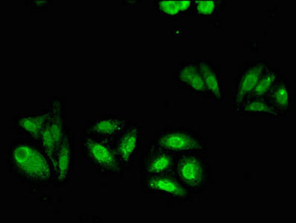 ABCC4 Antibody (PACO49366)