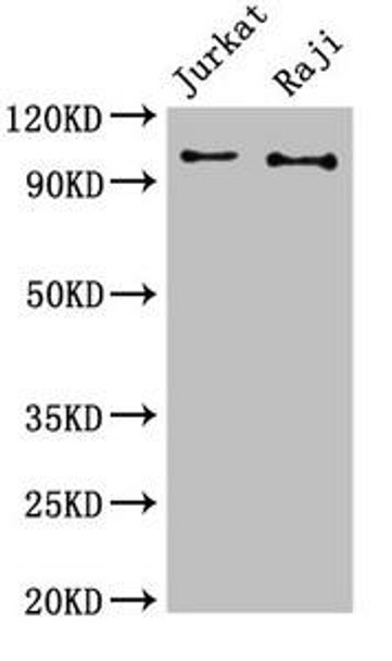 CBL Antibody (PACO49450)