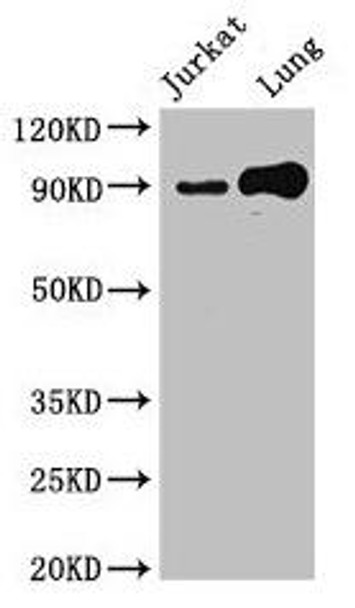 STAT5B Antibody (PACO50042)
