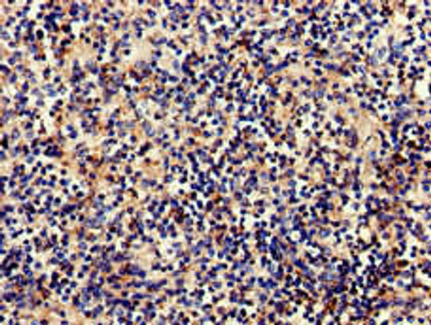 C1QA Antibody (PACO51362)