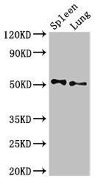 PSEN2 Antibody (PACO51882)