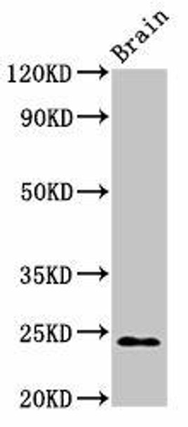 NDUFS8 Antibody (PACO55678)