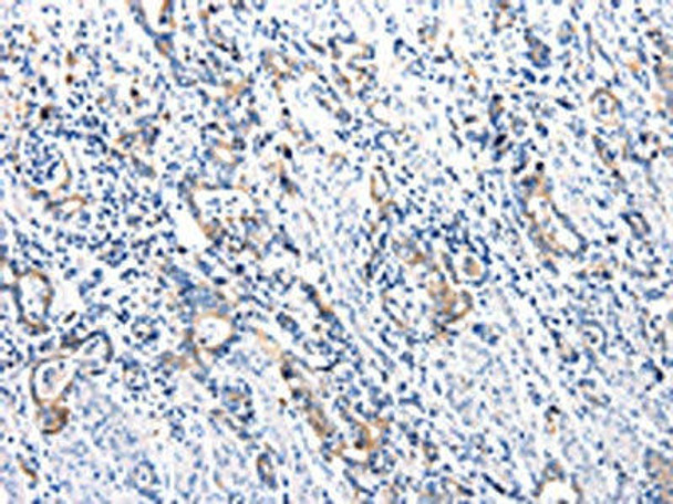 UTS2 Antibody (PACO13811)