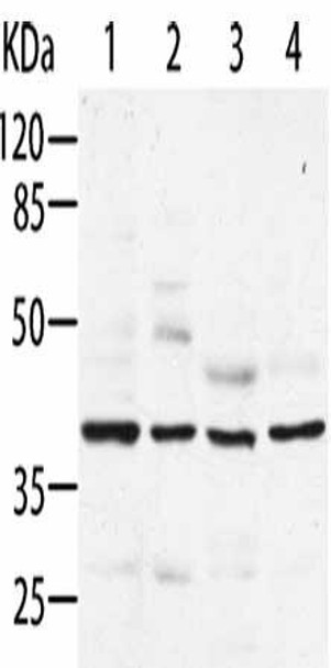 AIMP2 Antibody (PACO13923)