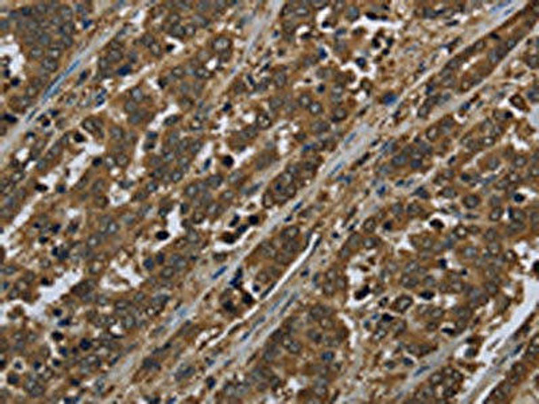 SNCG Antibody (PACO13926)