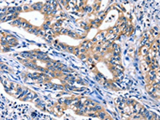 CDK2 Antibody (PACO14220)
