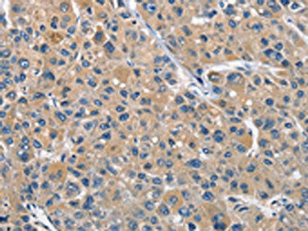 CLEC2D Antibody (PACO14258)