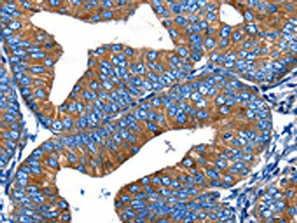 MERTK Antibody (PACO14263)