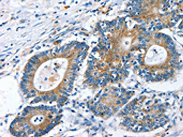 RAF1 Antibody (PACO14291)