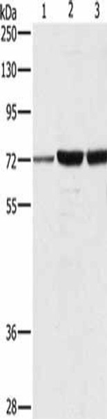 DOK1 Antibody (PACO14352)