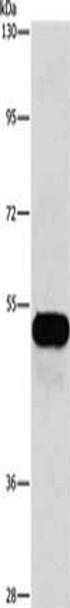 CFLAR Antibody (PACO14418)