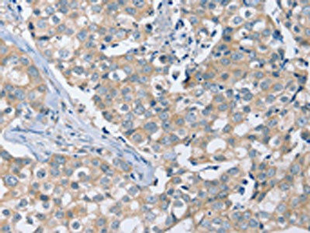 PEA15 Antibody (PACO16854)