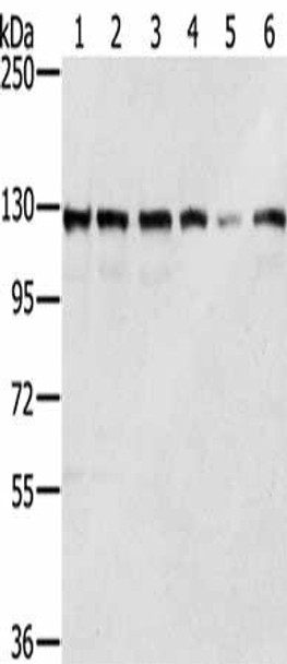 RNF20 Antibody (PACO16998)