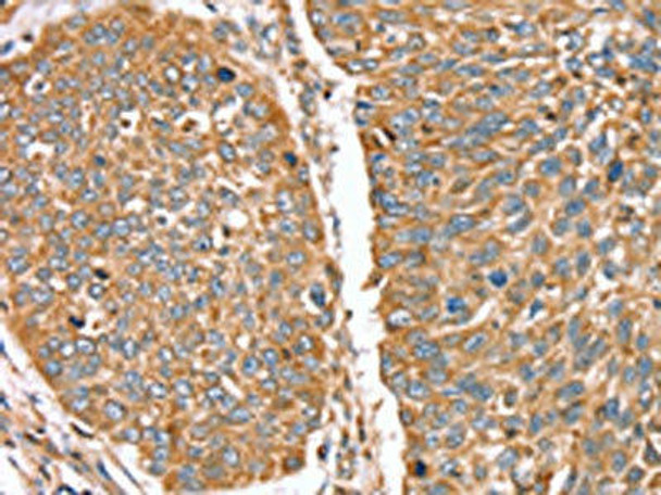 RNF11 Antibody (PACO17000)