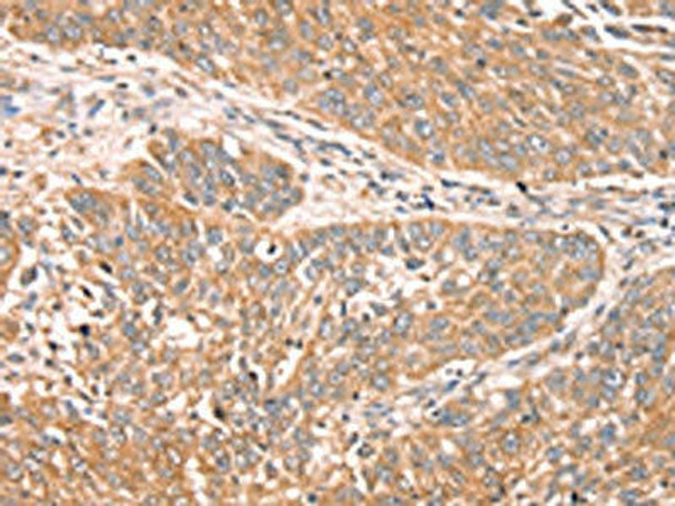 RPS6KA1 Antibody (PACO17022)