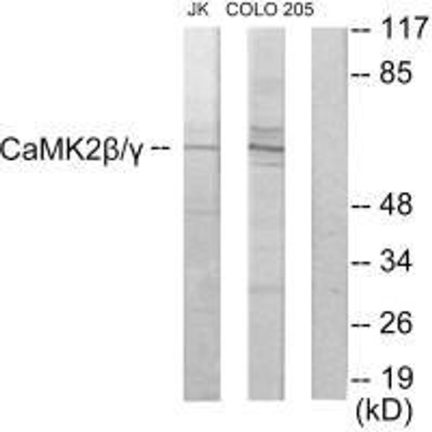 CAMK2G/CAMK2B Antibody (PACO21838)