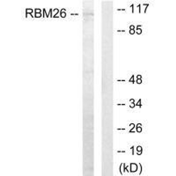 RBM26 Antibody (PACO21876)