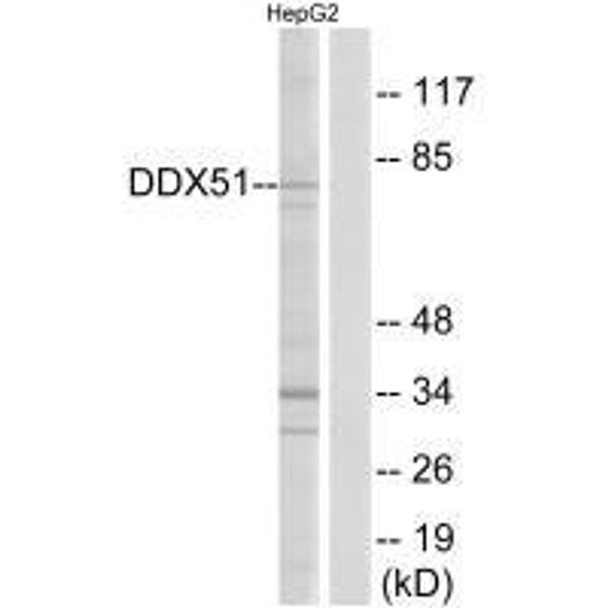 DDX51 Antibody (PACO22178)