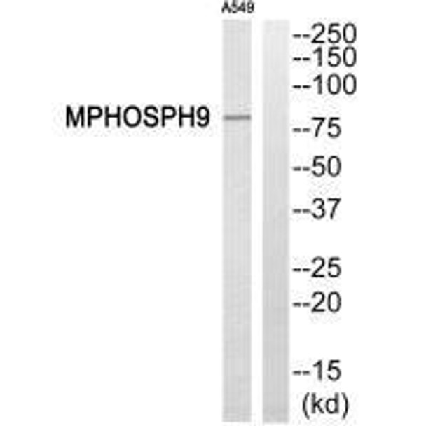 KIF20B Antibody (PACO22429)
