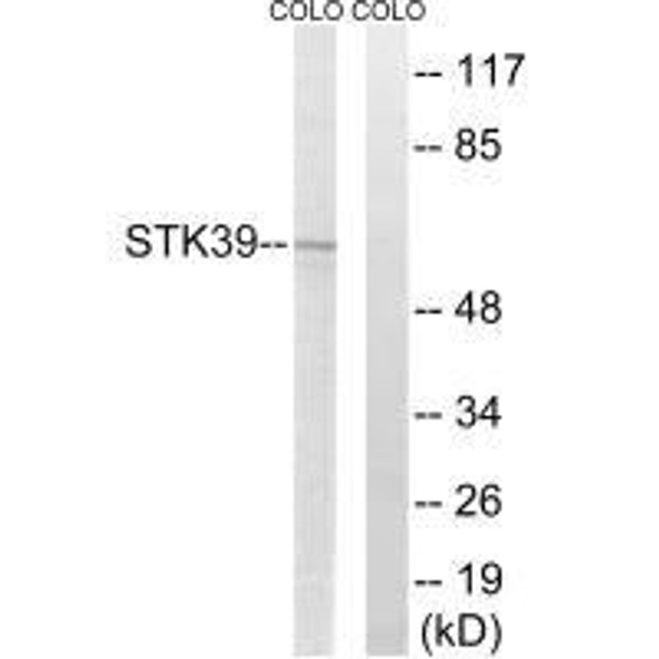 STK39 Antibody (PACO22636)