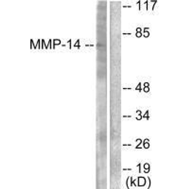 MMP14 Antibody (PACO23123)