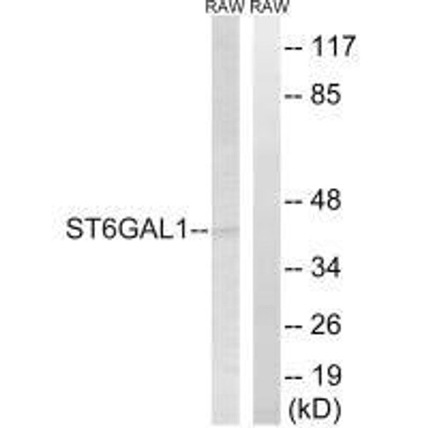 ST6GAL1 Antibody (PACO23417)