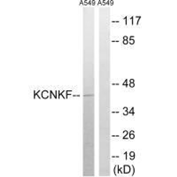 KCNK15 Antibody (PACO23462)