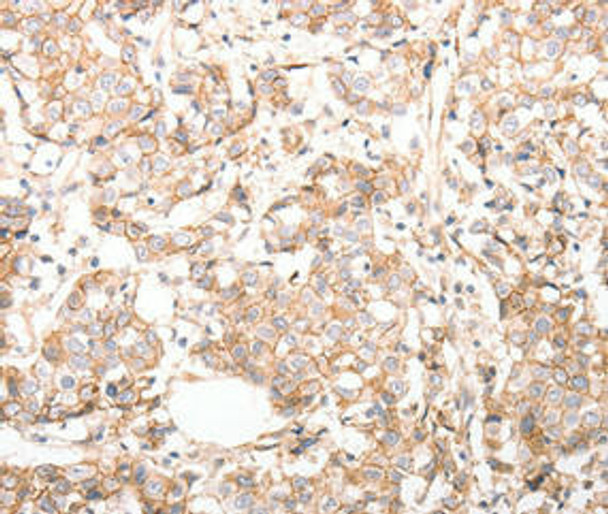 CDH23 Antibody (PACO23525)