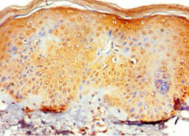 RNF125 Antibody (PACO43476)