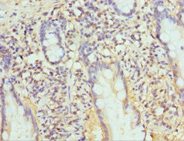 PSMB10 Antibody (PACO44185)