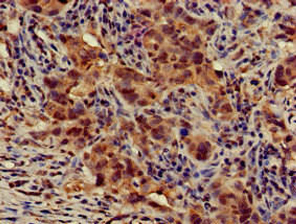 ATG14 Antibody (PACO50662)
