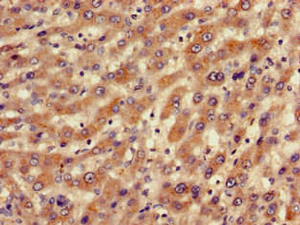 BBS10 Antibody (PACO50806)