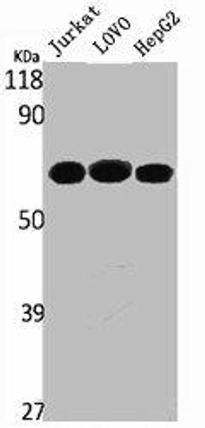 PTPN11 Antibody (PACO06812)