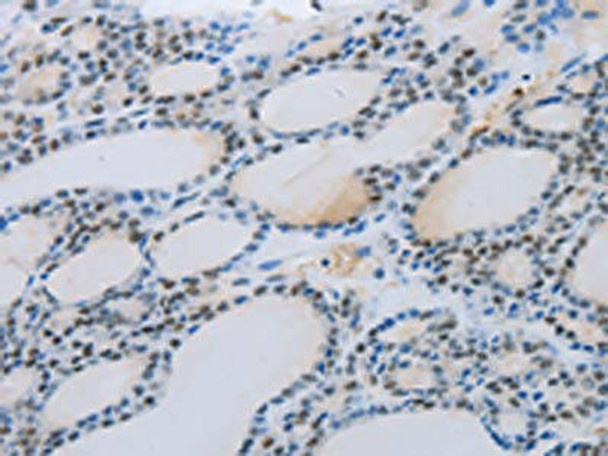 MMP21 Antibody (PACO18230)