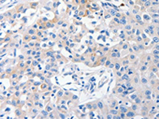 SLC10A1 Antibody (PACO18310)