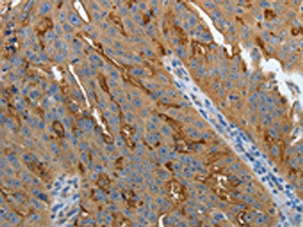 SLC34A2 Antibody (PACO18410)