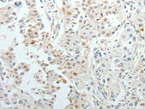 TOP1MT Antibody (PACO18454)
