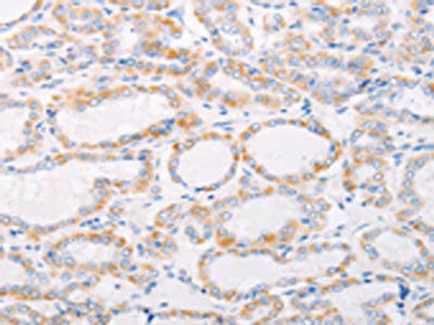 ANKRD26 Antibody (PACO18565)