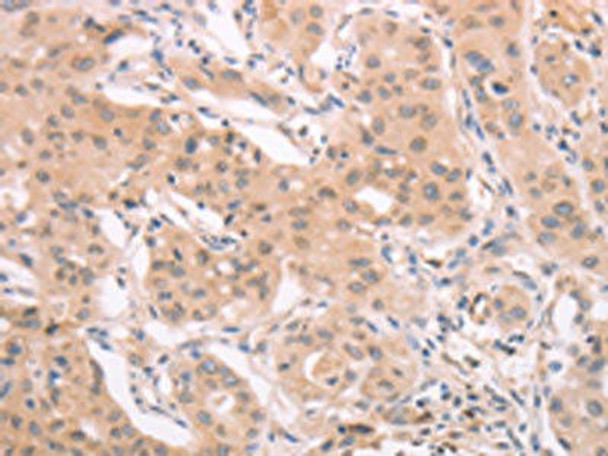 ADAM11 Antibody (PACO19051)