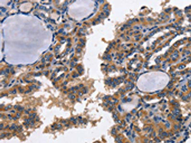 CD48 Antibody (PACO19432)