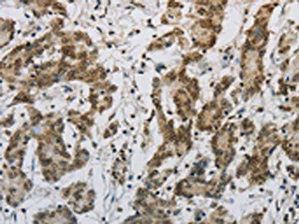 HIST1H2AB Antibody (PACO19761)