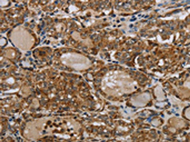 MT-ND6 Antibody (PACO20047)