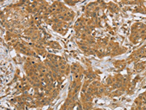 KCNJ15 Antibody (PACO20348)